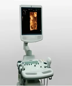 Máy Siêu Âm Màu 4D